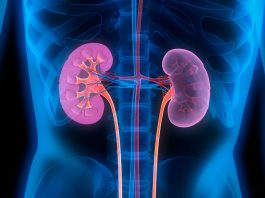 acute kidney injury